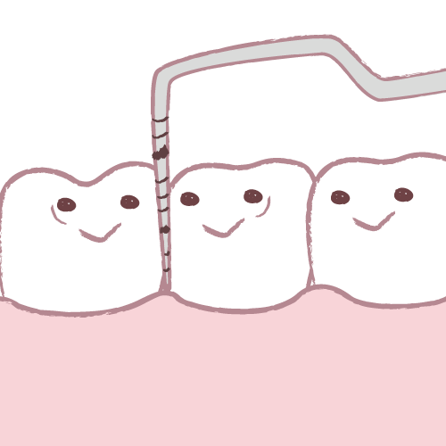プロービング検査